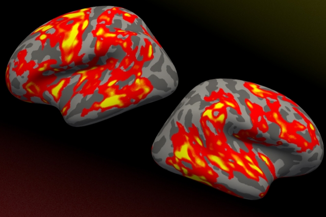 Brain Regions
