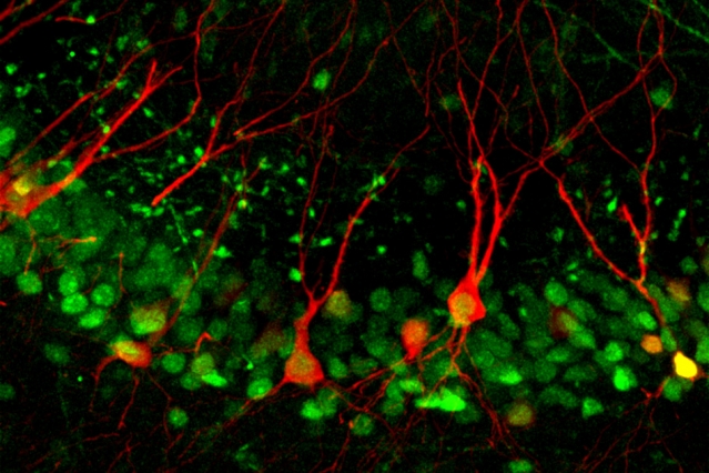 neuron